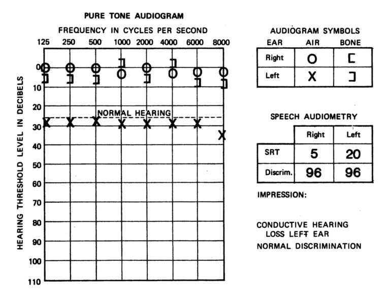 Blank Audiogram Template Download