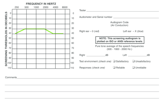 Blank Audiogram Template Download - Fill Online, Printable within Blank Audiogram Template Download