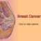 Breast Cancer – Animated Powerpoint Template ~ Free Medical Inside Free Breast Cancer Powerpoint Templates