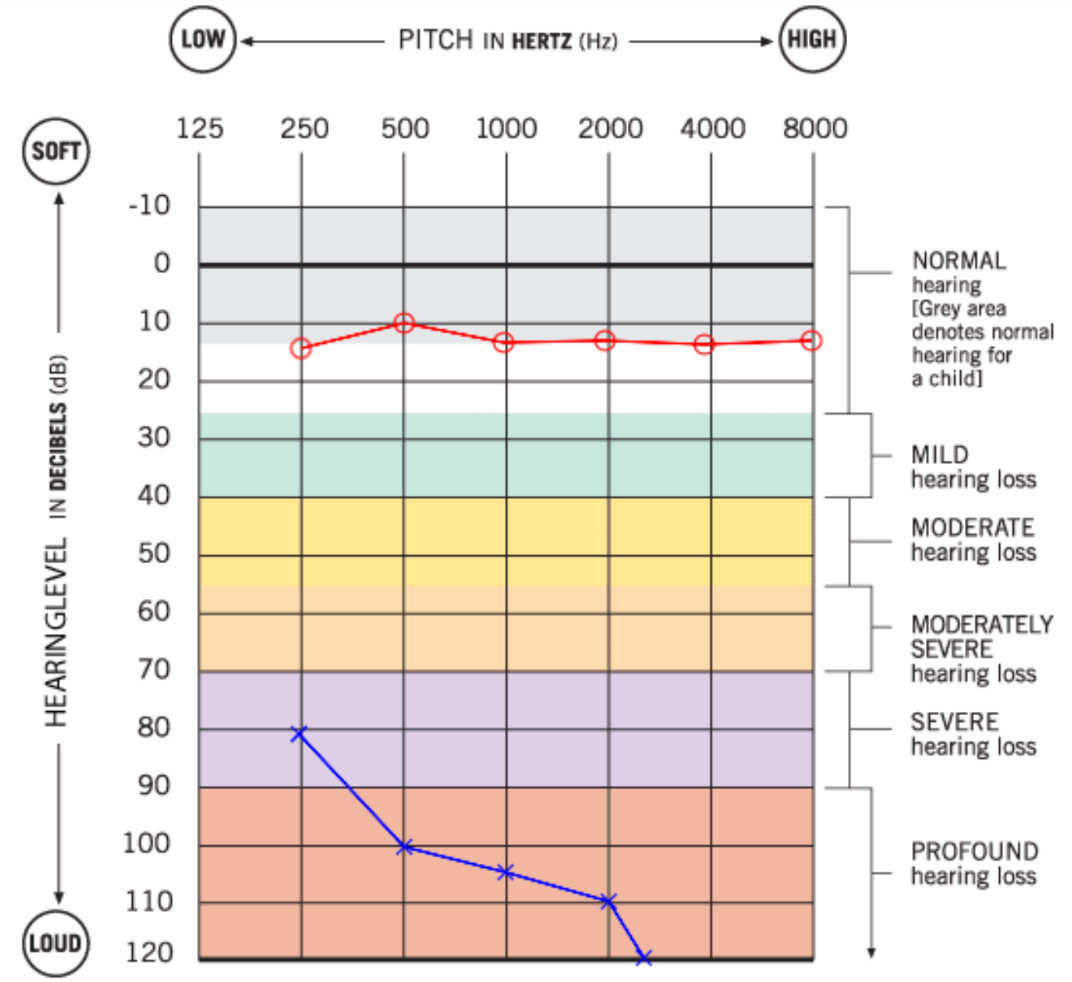 Cuny | I Look So I Can Hear. Within Blank Audiogram Template Download
