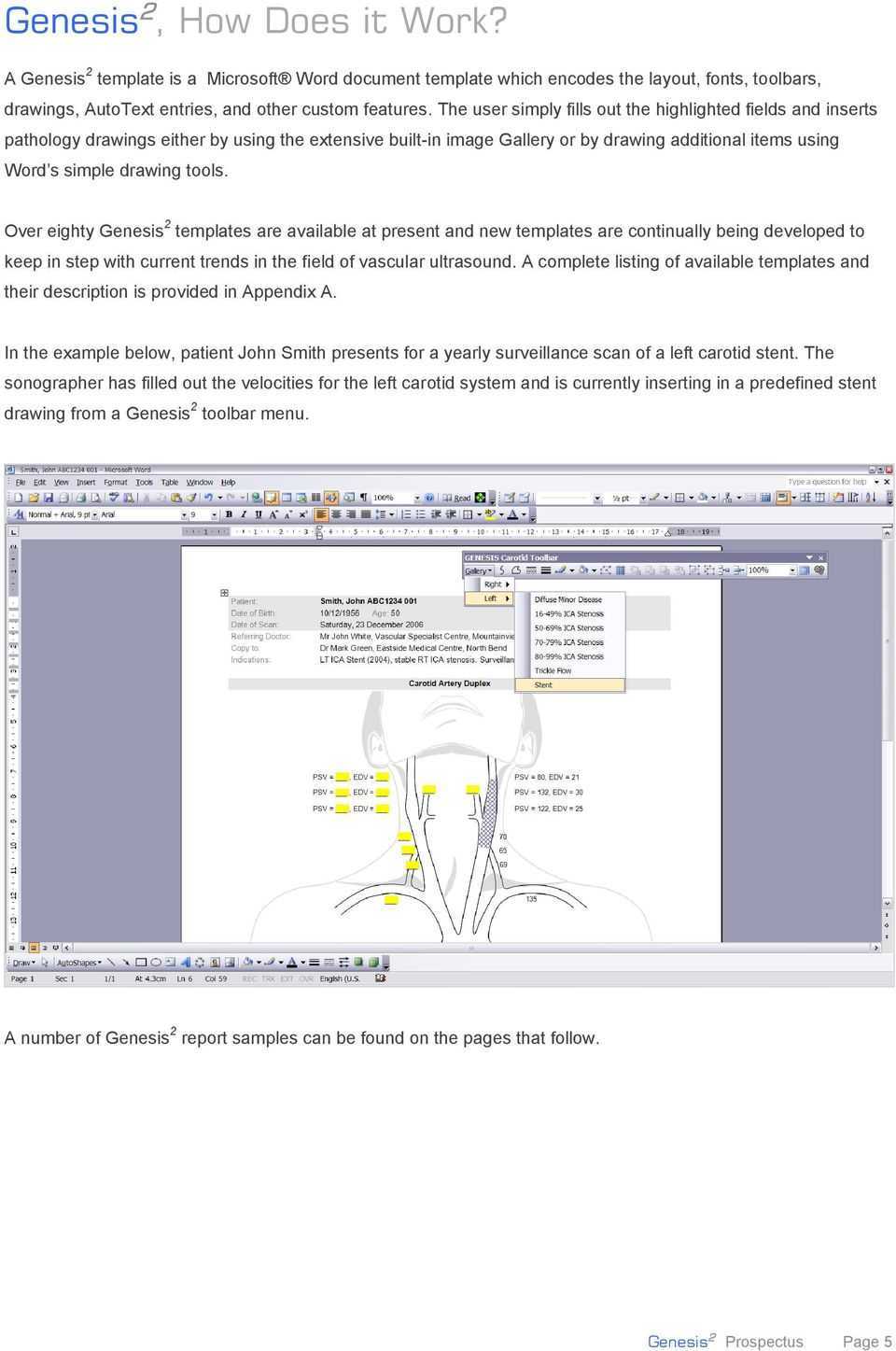 Genesis 2 System For Reporting Of Vascular Laboratory Intended For Carotid Ultrasound Report Template