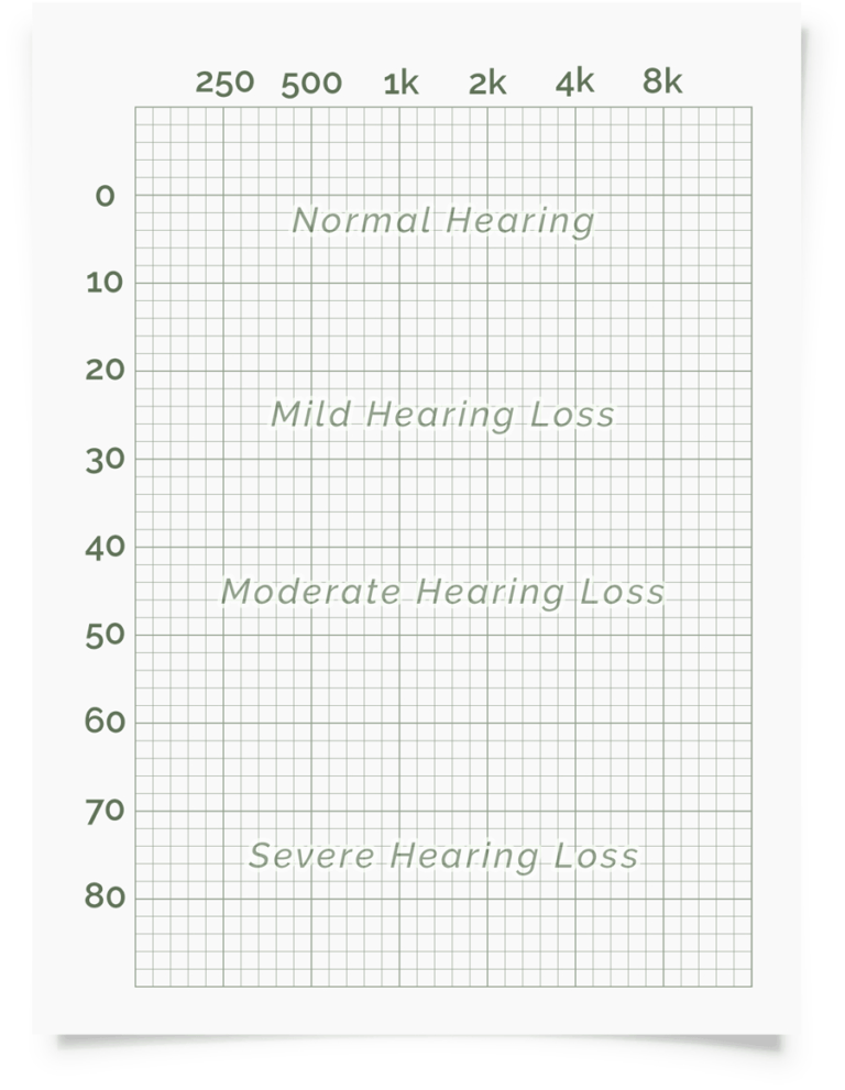 Blank Audiogram Template Download Professional Template Blank Audiogram Template Download Professional Template