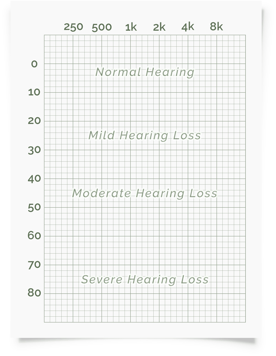 Online Hearing Test & Audiogram Printout Throughout Blank Audiogram Template Download